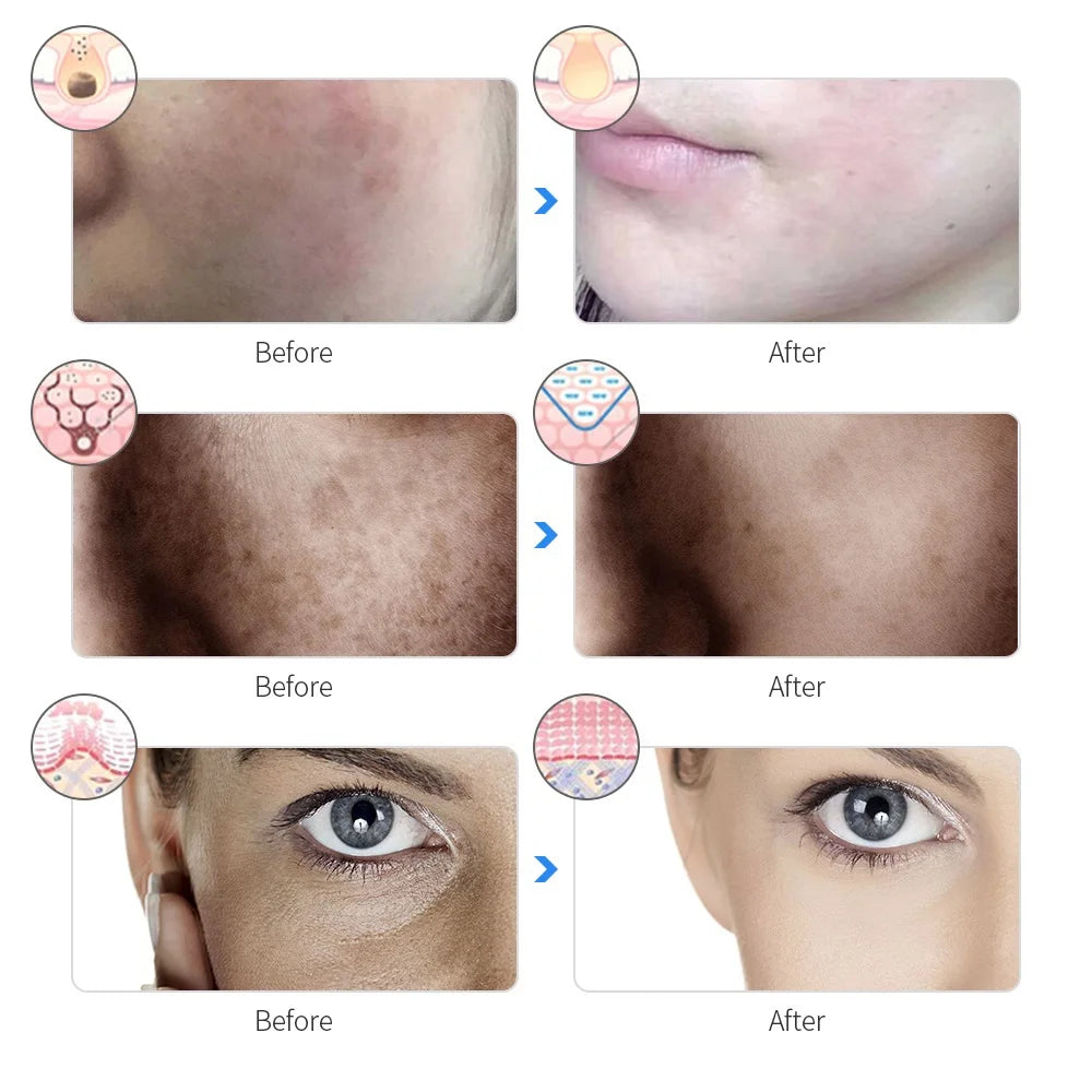 Rechargeable LED Beauty Mask – Anti-Ageing & Whitening