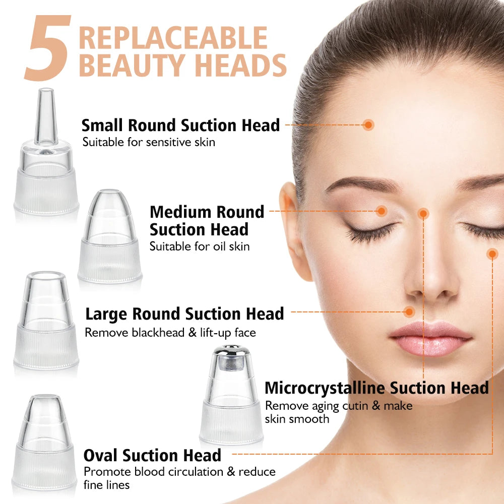 Limpiador de poros facial: removedor eléctrico de puntos negros y aspirador de acné