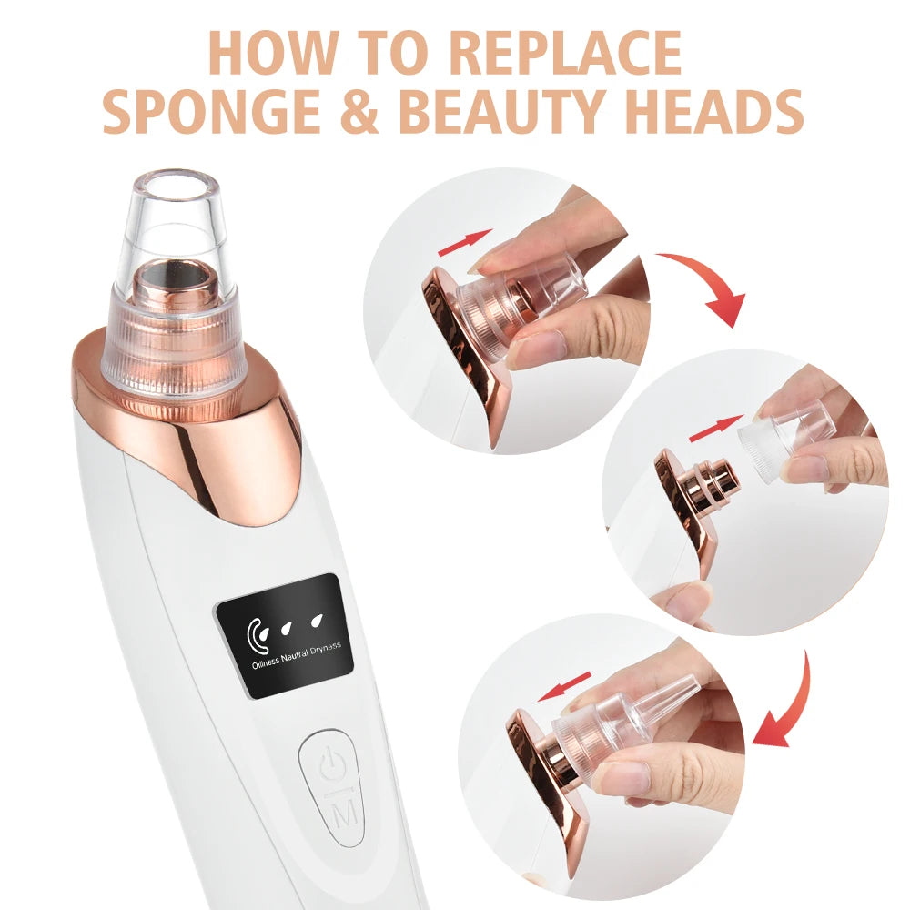 Limpiador de poros facial: removedor eléctrico de puntos negros y aspirador de acné
