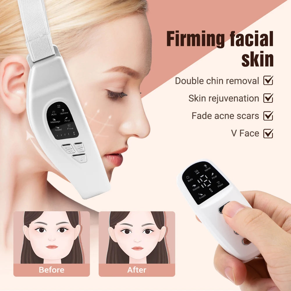 5-in-1 Face Lifting Massager – Double Chin Reducer with Remote Control