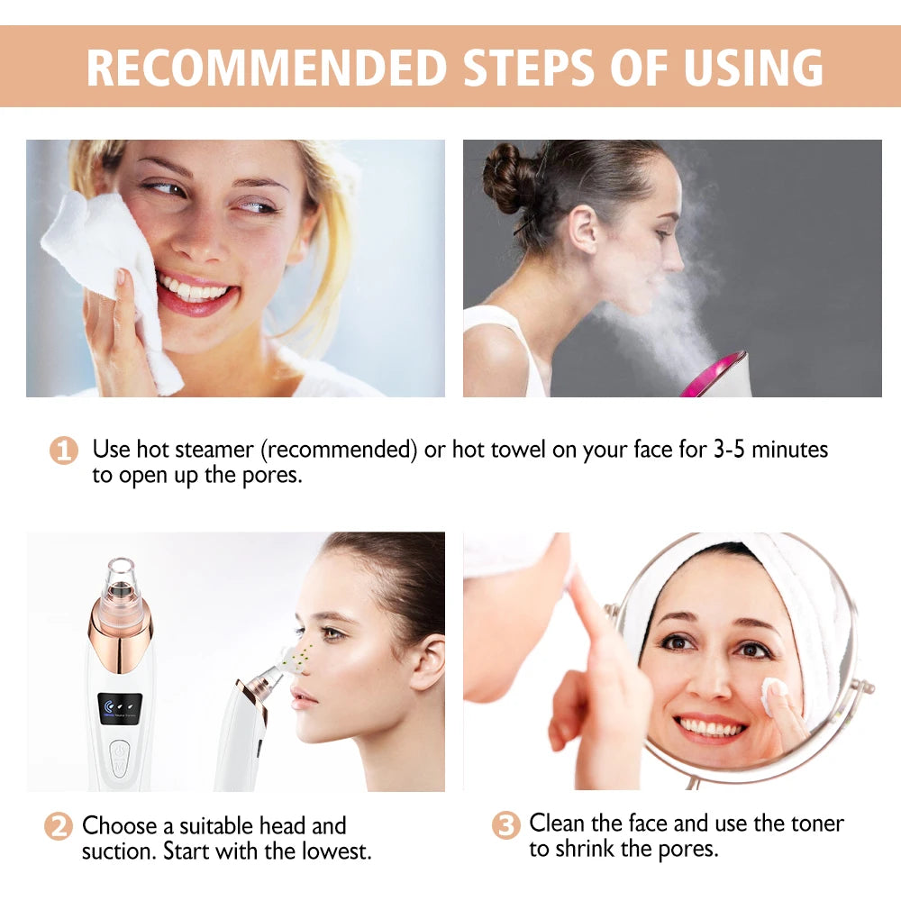 Limpiador de poros facial: removedor eléctrico de puntos negros y aspirador de acné