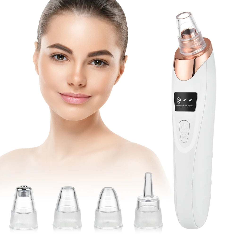 Limpiador de poros facial: removedor eléctrico de puntos negros y aspirador de acné